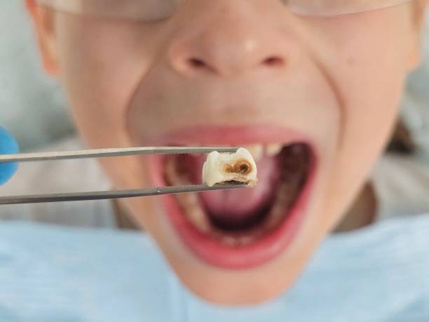 Best Pediatric Emergency Dentist in Cut Bank, MT